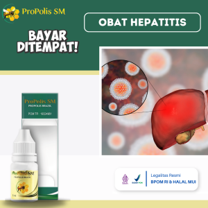 Obat Hepatitis Obat Hepatitis Akut Obat Hepatitis Kronis Obat Liver Obat Liver Perut Bengkak Obat Sirosis Hati Mata Kuning Limpa Nyeri Ulu Hati Sakit Perut Kembung Dengan Propolis SM