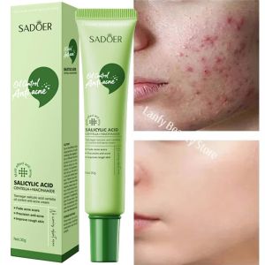Salicylic Acid Acne Treatment Face Cream Repair Pimple Spots Deep Cleaning Pore Anti-acne Scar Oil Control Moisturizer Skin Care2026