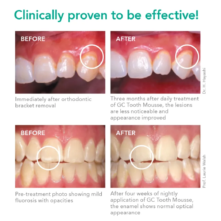 GC%20TOOTH%20MOUSSE%20PLUS%20WITH%20EXTRA%20MILK%20PROTEIN%20VANILLA%2040G%20Expiry%20May%202027%20-%20Image%204