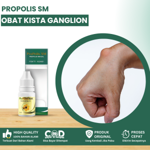 Obat Kista Ganglion Obat Benjolan Di Tangan Obat Penghilang Kista Ganglion Di Pergelangan Tangan Obat Benjolan Di Pergelangan Sendi Obat Benjolan Keras Berisi Cairan Benjolan Lipoma Kelenjar Getah Bening Dengan Propolis SM