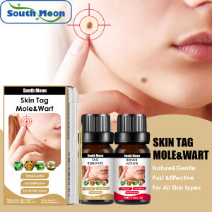 Nốt ruồi và da nhãn tag Remover da sửa chữa Kem dưỡng da vẻ đẹp và chăm sóc da sản phẩm South Moon tag mole & wart Kit làm sạch sâu sửa chữa và làm mịn da