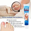 [SUMIFUN Nail Fungus Treatment Anti Fungal Cream 20g] Fungisol Antifungal Nail Repair Cream Fungisol Antifungal and Paronychia Treatment Onychomycosis Broken Nail Infection Effective Anti-Fungal Hand Foot Skin Care. 