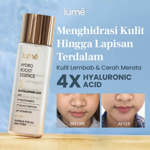 Lume Hydro Boost Essence Hydrating Toner Mencerahkan Wajah Niacinamide 5% Skincare Bpom