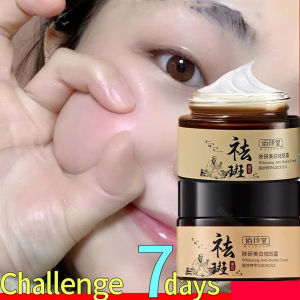 【HCM】【Hết tàn nhang nhanh trong 7 ngày】 Kem xóa tàn nhang đồi mồi Kem Làm trắng Hot sale giảm giá Kem trắng da và xóa tàn nhang 30g Nám tàn nhang hiệu quảLàm mờ thâm nám tàn nhankem thâm nám tàn nhang đồi mồiSăn chắc da kem dưỡng ẩm cho mặt