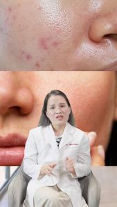 Sữa Rửa Mặt ZO EXFOLIATING (da dầu) & GENTLE (mọi loại da) & HYDRATING (da khô) 200ml