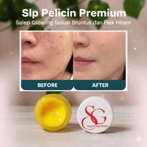 Saymay Beauty Jelly Pelicin Wajah Glowing Premium - Penghilang Flek Hitam & Jerawat Multi-Pak untuk Semua Jenis Kulit