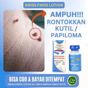 Lotion 𝐏𝐄𝐍𝐆𝐇𝐈𝐋𝐀𝐍𝐆 𝐊𝐔𝐓𝐈𝐋 / Penghilang Tahi Lalat / Swiss Paris Lotion