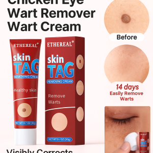 Wart Cream Safe and Non-irritating Mild and Beneficial Wart and Wart Cream Herbal Ingredients