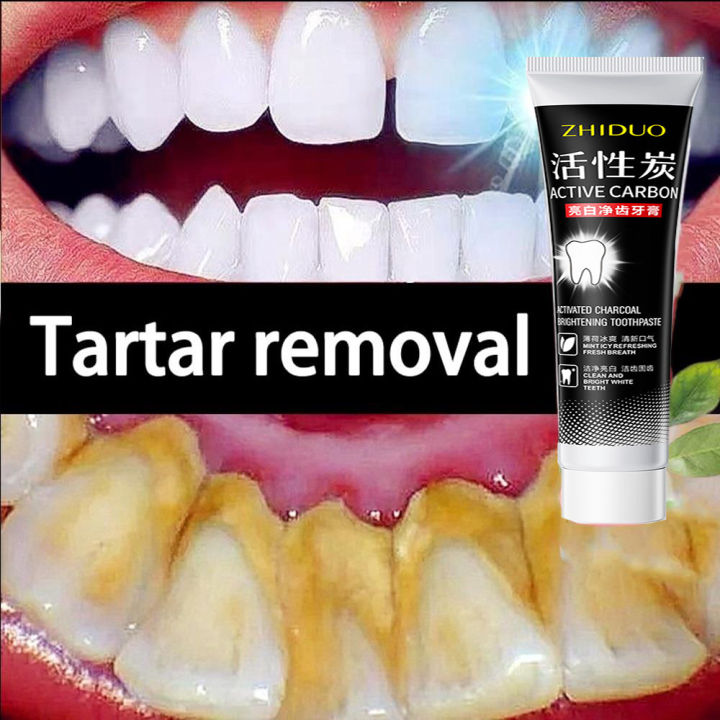 Best Toothpaste For Plaque And Tartar Removal Whitening Toothpaste Tooth Whitening Toothpaste Activated Charcoal