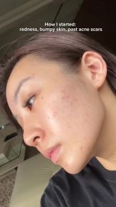 【Flash Sale】France Caudalie Vinoperfect Brightening Dark Spot Vino Perfect Vitamin C Retinol Glass Skin