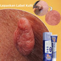 Obat Kutil Paling Ampuh Wart Remover Krim Penghilang Kutil Salep Kutil Penghilang Kutil Wajah Menghilangkan Kutil Filiform. 