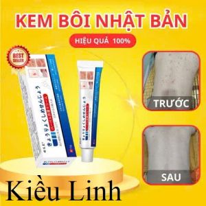 [ SIÊU HOT ] Kem Bôi Viêm Da Cơ Địa NHẬT BẢN Lác Đồng Tiền Nấm Da Đầu Ghẻ Nước Á Sừng Cực Kì Hiệu Quả