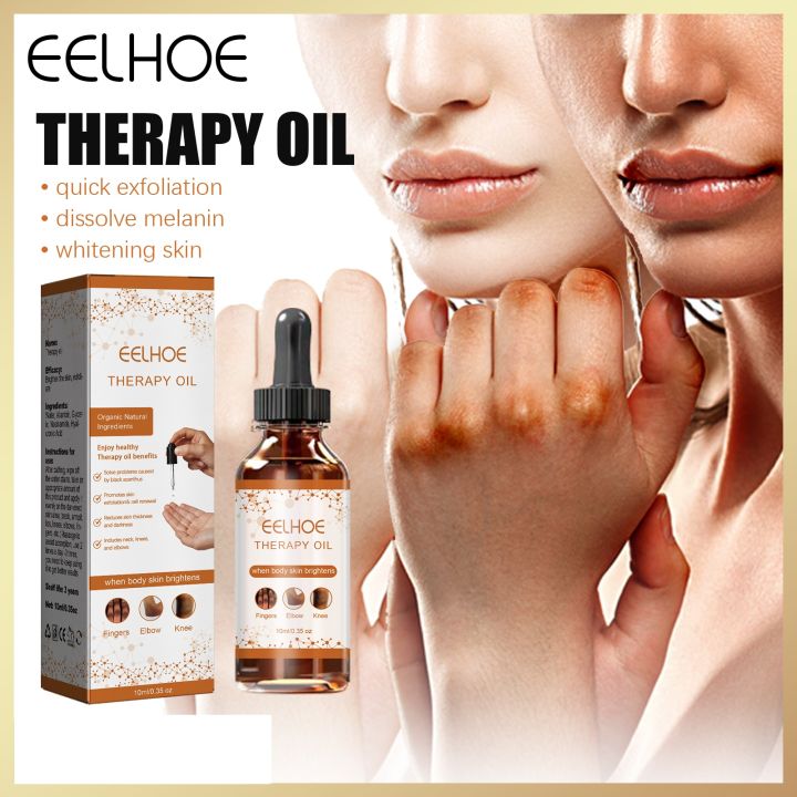 Eelhoe Therapy Oil Acanthosis Nigricans Dark Spot Therapy Drops