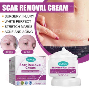 Surgical Scar Removal Cream Gel Treatment for Stretch Marks Burns Acne Spot Repair Smoothing Whitening Facial Body Skin Care Cream Fading Scars Smoothing Skin Repair Wounds Skin Repair Cream Legs Old Scar Removal Cream 50g