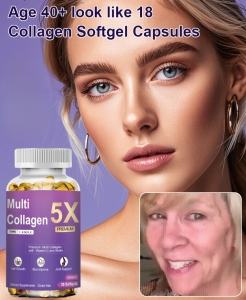 Collagen Supplement Vitamins Wrinkle Reduction Collagen Nutrients Improve Skin Condition Joint Health