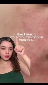 [Reday stock]PURITO  Centella Asiatica Unscented Essence 34860 ppm  Centella asiatica  Facial essence  Suitable for sensitive skin and acne-prone skin  Soothing Essence  Vegetarian  Hypoallergenic  South Korea Skin Care 2  Fluid Ounce /60  Ml