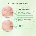 ⭐ ⭐READY STOCK⭐ ⭐ Glad2Glow Centella Allantoin Soothing Moisturizer Gel Repair Skin Barrier Oil-Control Hydrating Moisturizer Cream (55g). 