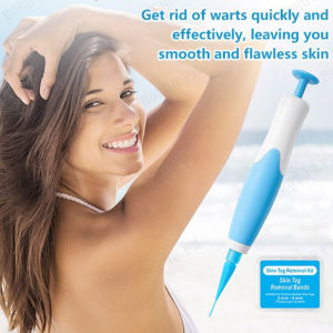 Get Rid of Skin Tags Warts and Corns with DualHeaded Tool