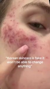 [Hot sale ]Medicube Collagen Jelly Cream-type Repair Barrier Moisturizing Smooth and Fine. 110 ml.