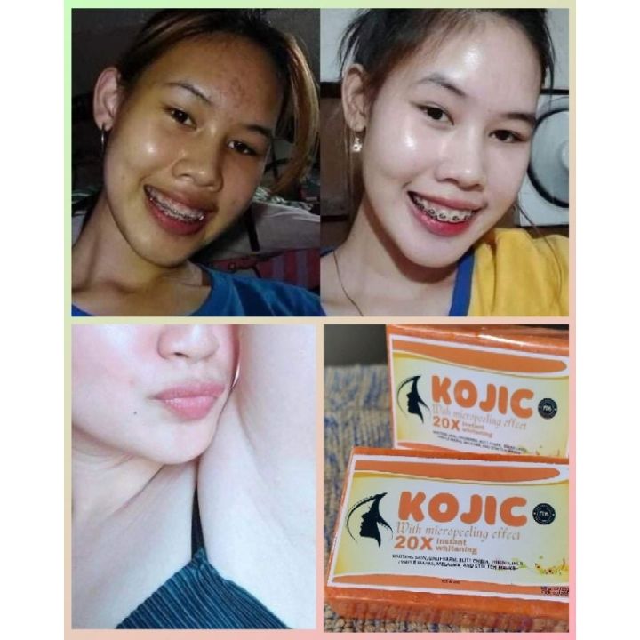 TRENDING KOJIC PAPAYA+GLUTATHIONE & COLLAGEN 120g Lazada PH