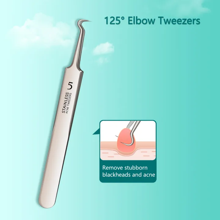 Blackhead%20Remover%20Tweezers,%20Blackhead%20Remover%20Comedone%20Extractor%20Stainless%20Steel%20Precision%20Pimple%20Popper%20Tool%20for%20Whitehead%20Acne%20Blemishes%20-%20Image%208