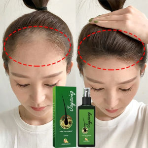 Ready stock🇲🇾[Spot goods]Ginger Hair Growth Spray 120ml Hair Growth Serum  Ginger hair growth serum  Anti Hair Loss Essence Fast Growing Treatments