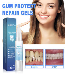 Tooth Repair Gel  Firm Tartar Deep Cleaning Gum Pain Repair