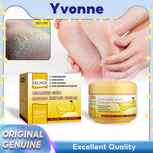 EELHOE Anti-Crack Cream Banana Skin Repair Itch Blisters Cracking Anti-chapping Peeling Repair for Hand and Foot Care Feet Cream Foot Crack Cream Heel Chapped Peeling Repair Dead Remover Banana Oil Repair Skin Care Product Anti-Drying Crack Cream