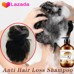 Ginger hair growth shampoo ASLI Anti-hair loss shampoo hair regrowth Middle-aged hair loss stay up late hair loss postpartum oil control dandruff