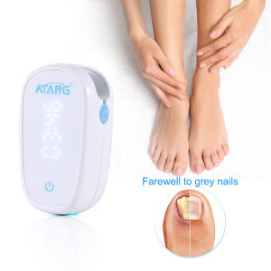 Onychomycosis treatment of toenail fungus laser nail fungal repair infrared led light therapy
