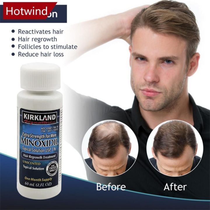 ON-HAND! Kirkland Minoxidil 5% Topical Solution USP, 1 Month Supply ...