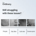 The Ordinary Niacinamide Serum For Face Niacinamide 10% + Zinc 1% Acne Treatment Acne Pimples Remover Effective Skin Care Skin Body Whitening Essence 30ml. 