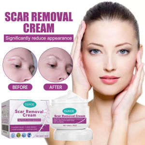 【High-quality】One Swipe to Smooth Dryness and Roughness! OUHOE Skin Care Ointment Deep Nourishment for Smooth Skin