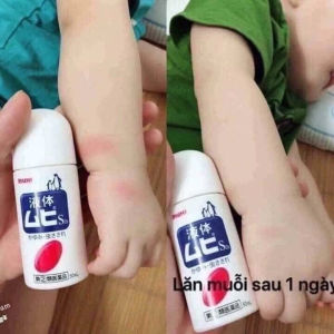 Lăn muỗi đốt Muhi Nhật Bản chính hãng 50g lăn bôi giảm ngứa muỗi và côn trùng đốt cho bé từ 6 tháng tuổi