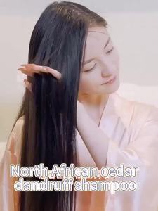 Anti dandruff shampoo hair treatment Dandruff remover Oil control 380ml Frizzy hair treatment