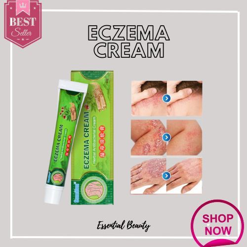 100% EFFECTIVE Sumifun Eczema Treatment Cream gamot sa kati kati sa ...