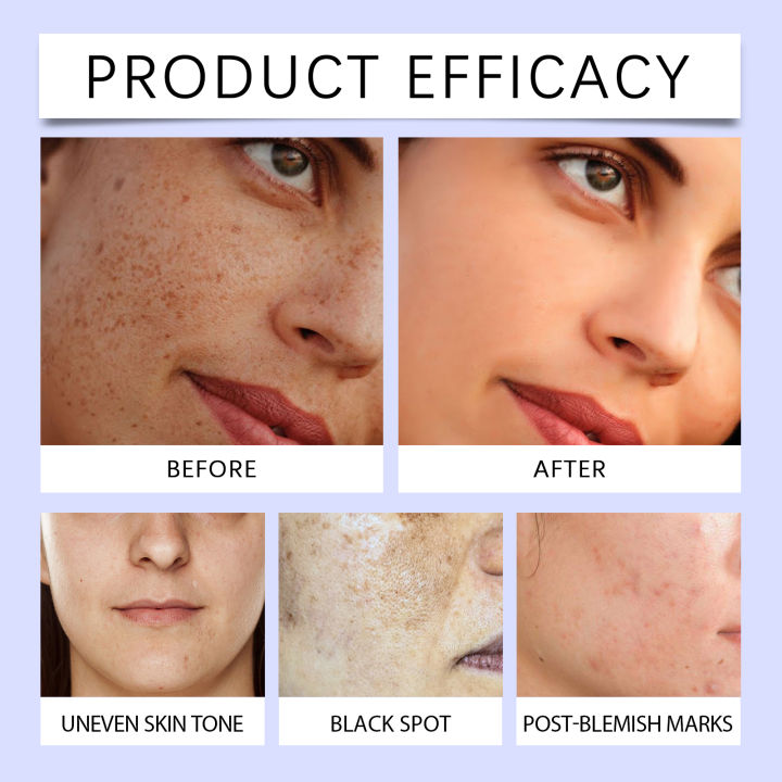 Facial%20Essence%20Helps%20Brighten%20Skin,%20Improve%20Dull%20Skin%20Tone,%20Moisturize,%20Bring%20about%20a%20Radiant%20Complexion,%20Nourish%20&%20Balance%20Moisture.%20-%20Image%206