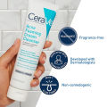 CeraVe Acne Cream Foaming Cleanser 4% Benzoyl Peroxide 150ml Pembersihan mendalam, kontrol minyak, memperbaiki jerawat wajah, komedo. 
