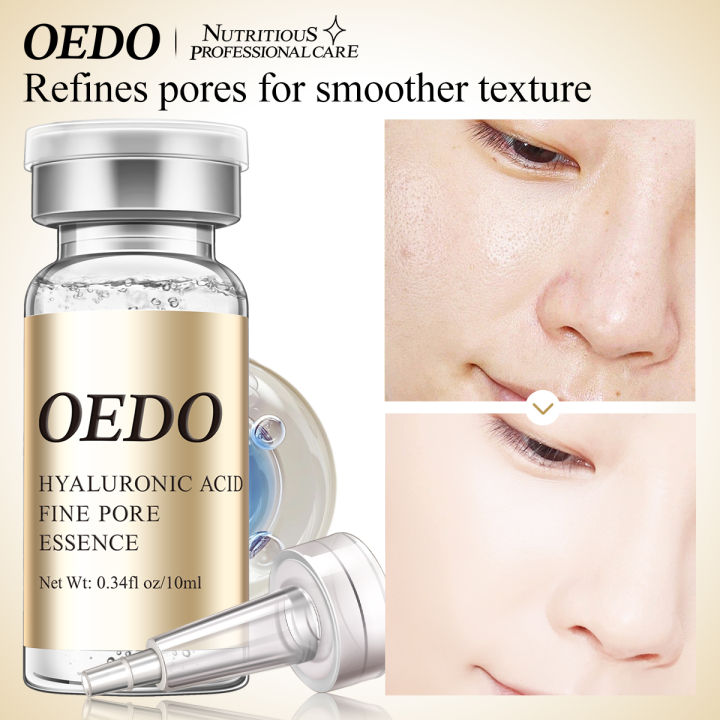 OEDO%20Serum%20tinh%20ch%E1%BA%A5t%20c%E1%BA%A5p%20%E1%BA%A9m%20se%20kh%C3%ADt%20l%E1%BB%97%20ch%C3%A2n%20l%C3%B4ng%20l%C3%A0m%20m%E1%BB%9D%20v%E1%BA%BFt%20ch%C3%A2n%20chim%20ng%C4%83n%20ng%E1%BB%ABa%20l%C3%A3o%20h%C3%B3a%20d%C6%B0%E1%BB%A1ng%20%E1%BA%A9m%20l%C3%A0m%20tr%E1%BA%AFng%20d%C3%A0nh%20cho%20nh%E1%BA%A1y%20c%E1%BA%A3m%20th%E1%BB%83%20t%C3%ADch%2010ml%20-%20Image%202