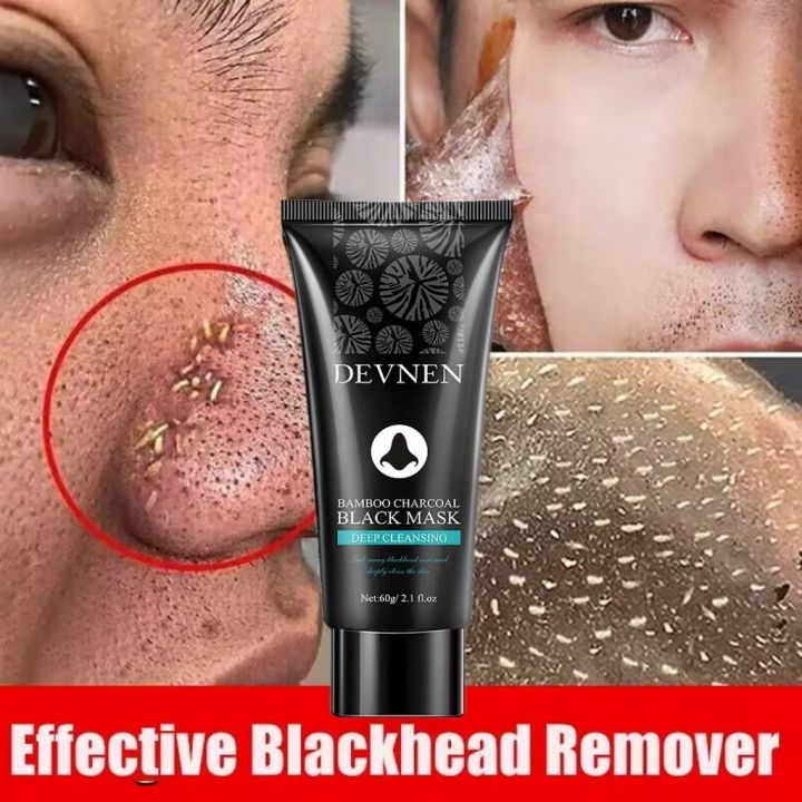 60g Blackhead Remover obviously Mask