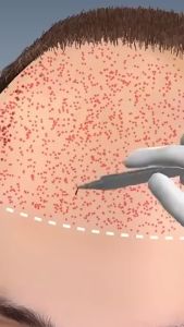 Supervita Hair Vitamin Malaysia  Biotin + Vitamin C for Stronger Thicker Hair