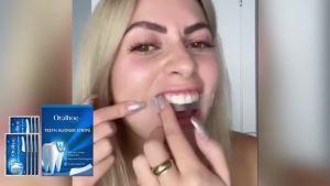 Oralhoe Teeth Whitening Strips Clean Plaque Stains Brighten Teeth Protect Gums Oral Care Whitening Strips