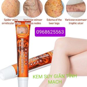 10 típ Kem bôi suy giãn tĩnh mạch co nhỏ tĩnh mạch Cực Hiệu Quả