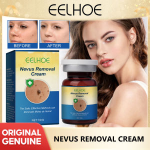Eelhoe Nevus Removal Cream Remove Dark Spots Brighten Lighten Melanin Improve Dull Anti-Aging Skin Care Nevus Repair Cream Whitening Body Cream Removal Of Hyperpigmentation For Dark Body Parts Like Neck Ankles