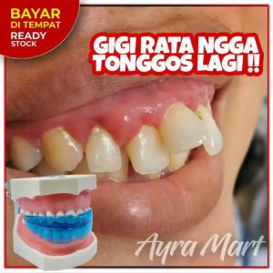 ( BISA COD ) Gigi Palsu tinggal pasang Snapon Smile ORIGINAL Authentic Snap On Smile 100%