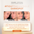 WARDAH 10% Vitamin C + Ferulic Acid Radiant Charge Serum 20 ml - Brightening Serum yang Menghilangkan dan Mencegah Noda Hitam Tak Terlihat untuk Kulit Cerah Lebih Lama - Skincare. 