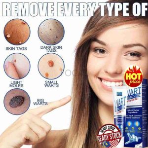 [READY STOCK] 20g Corn Skin Tag Warts Remover Ointment Wart Cream for Plantar Warts Removal