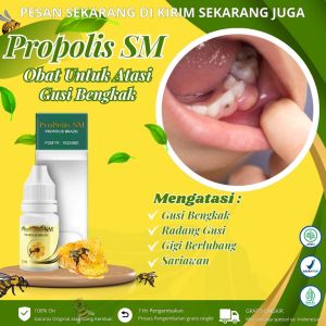 Propolis Sm - Obat Gusi Bengkak Gusi Berdarah Sakit Gigi Infeksi Gusi Bengkak Polip Gusi