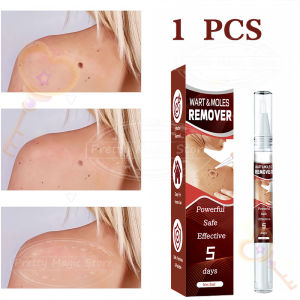 BUY 1 TAKE 1 Original Wart Removal Liquid Pen Hand Foot Warts Remove Filiform Flat Warts Condyloma Acuminatum Skin Tag Papillomas Moles Removal Liquid Point Mole Meat Particle Neck Flat Black Mole Wart Painless Repair Pen Visible Results In 7 Days (3ml)