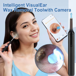 Smart Visual Ear Cleaner Wireless Earpick With Camera LED Light For Baby Adult Otoscope Endoscope Earwax Removal Kit Ear Cleaning Tool